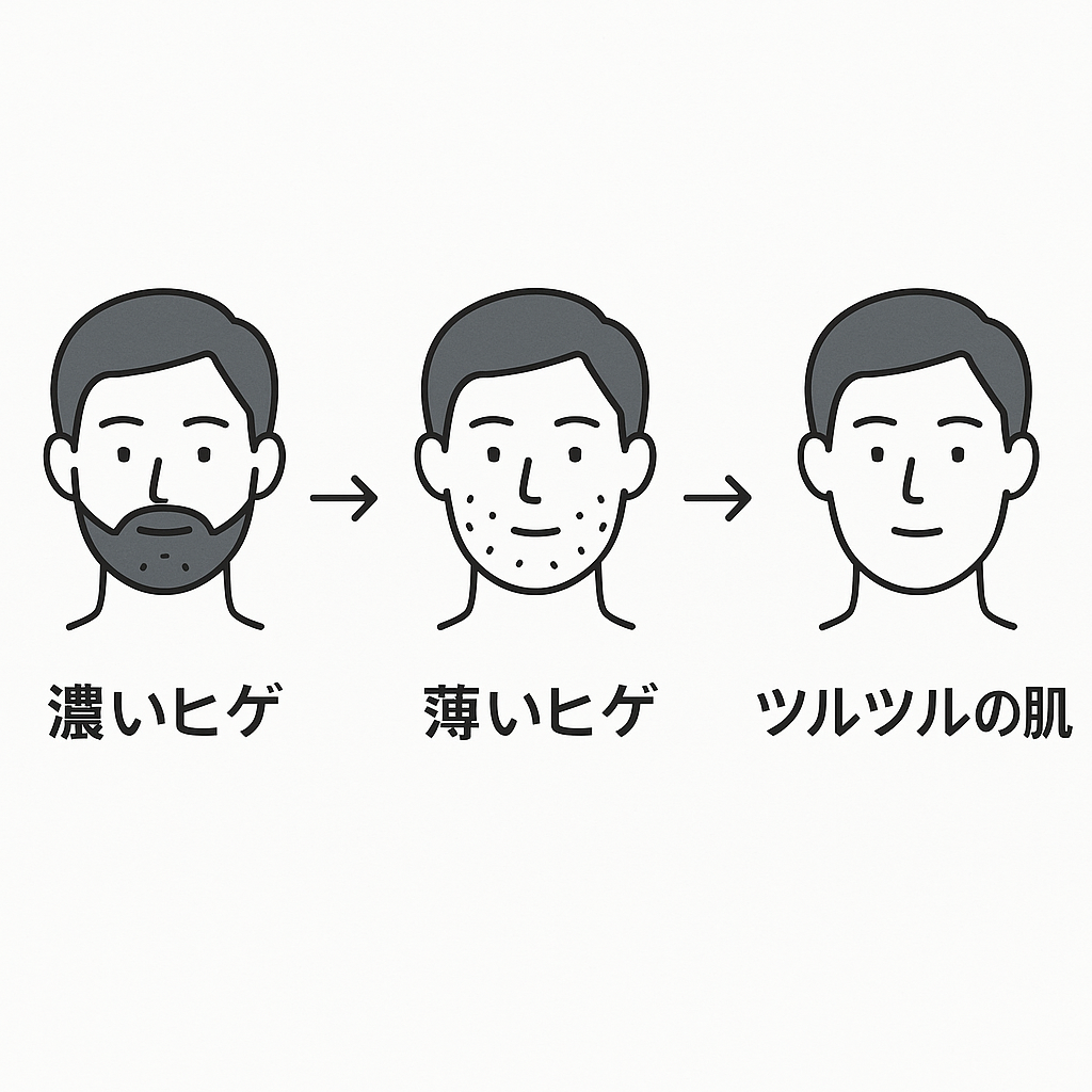 ヒゲ脱毛の回数ごとの効果の目安を示すイラスト